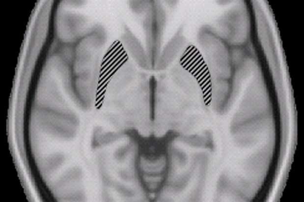 Innovation: Making Inroads to the Brain