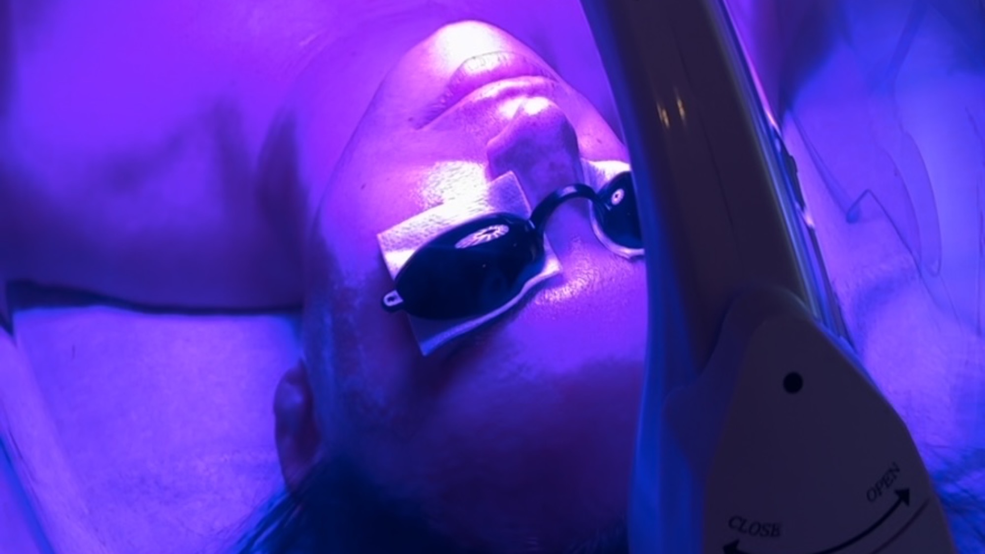 A person wearing protective goggles lies under a purple light during a facial treatment or light therapy session.